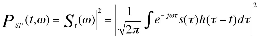 St() is the STFT. The spectrogram is the magnitude-square of the STFT.